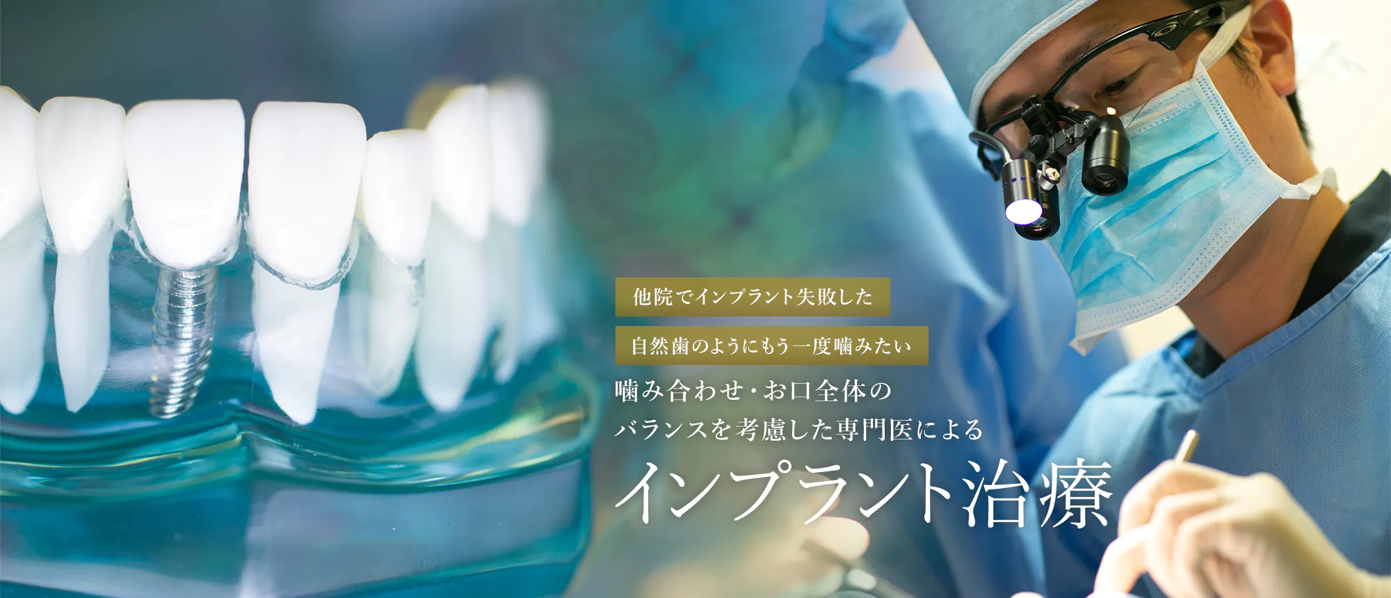 他院でインプラント失敗した 自然歯のようにもう一度噛みたい 噛み合わせ・お口全体の バランスを考慮した専門医による インプラント治療