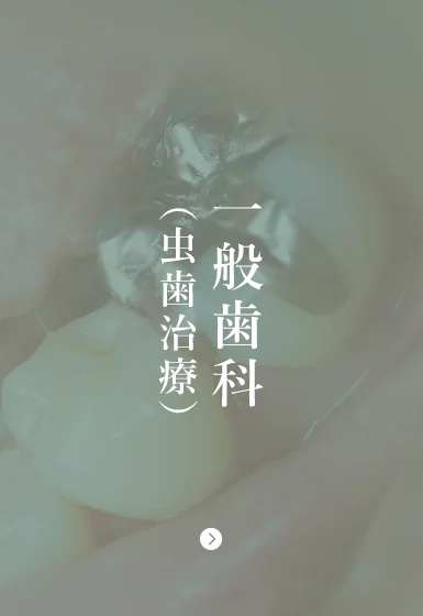 一般歯科 （虫歯治療）