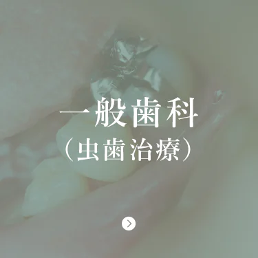 一般歯科 （虫歯治療）