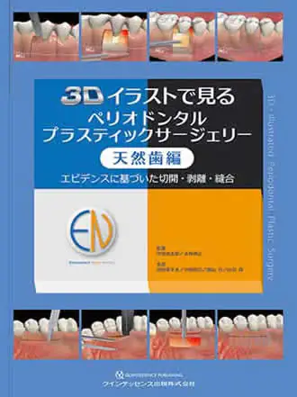 3Dイラストで見るペリオドンタルプラスティックサージェリー 天然歯編エビデンスに基づいた切開・剥離・縫合