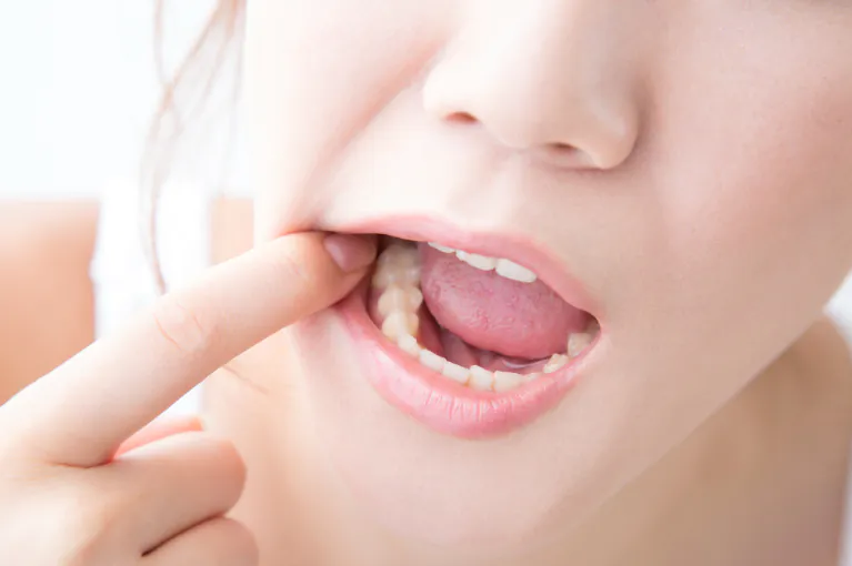 歯周病は「歯を失う原因」の第1位